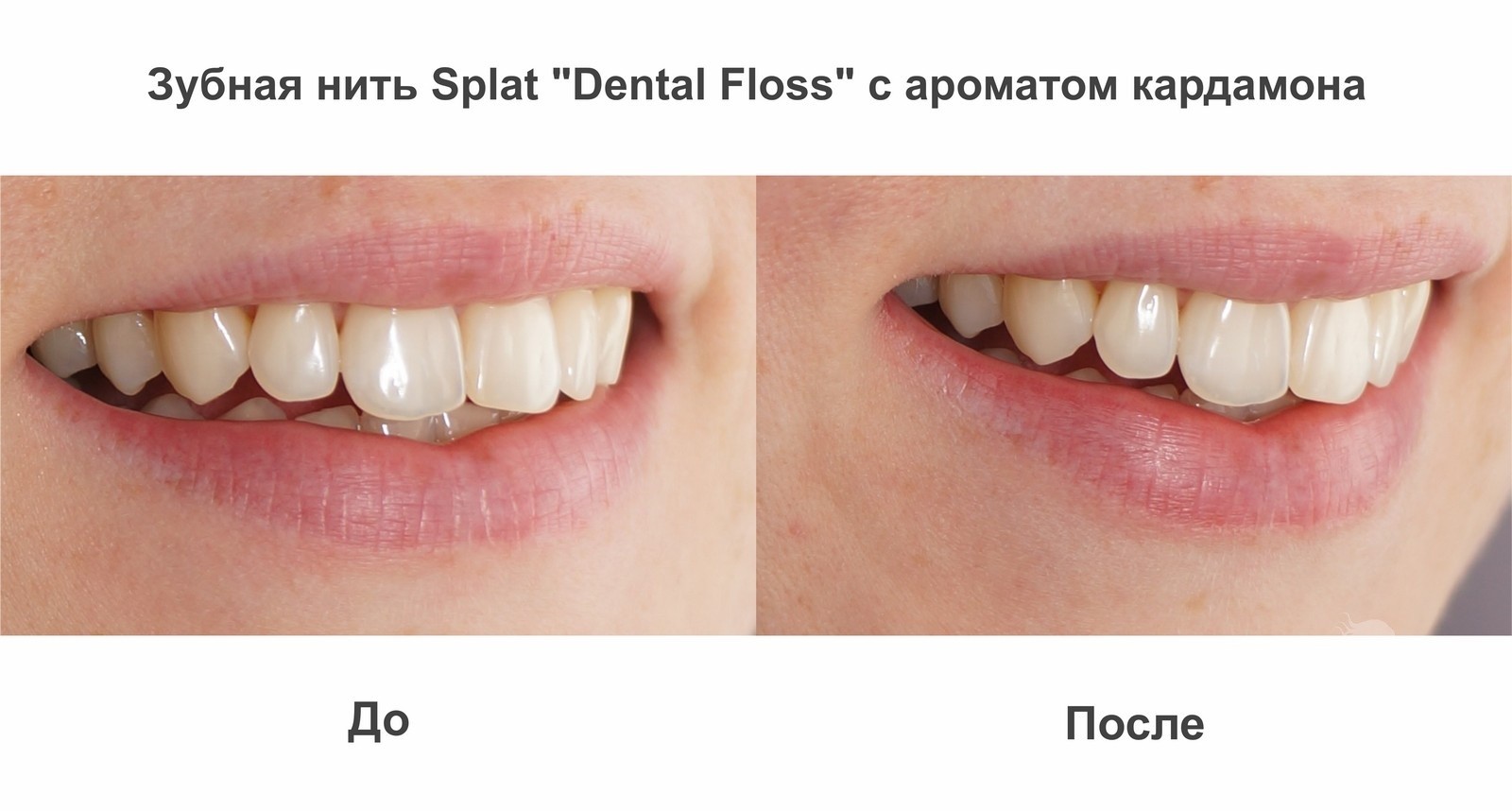 пелагея зубы до и после фото